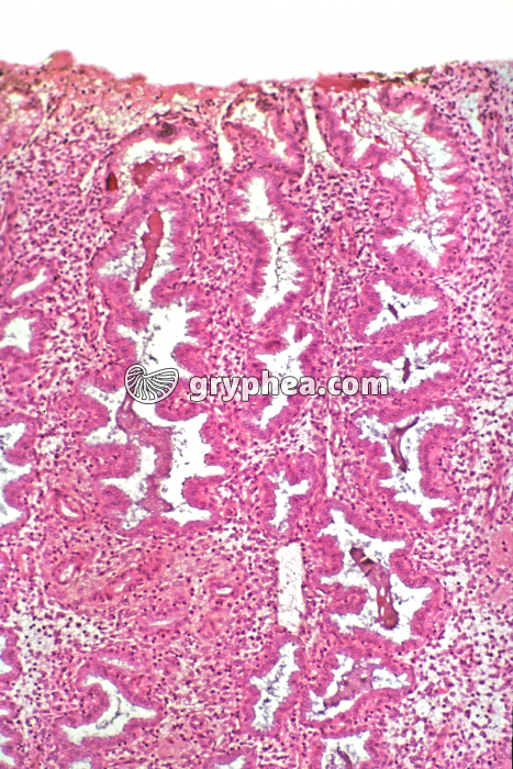 Endomètre sécrétoire x15 - gryphea.com